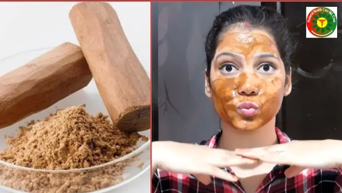 Beauty & Skincare Benefits of Sandalwood
